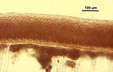 4 - Sezione longitudinale radiale